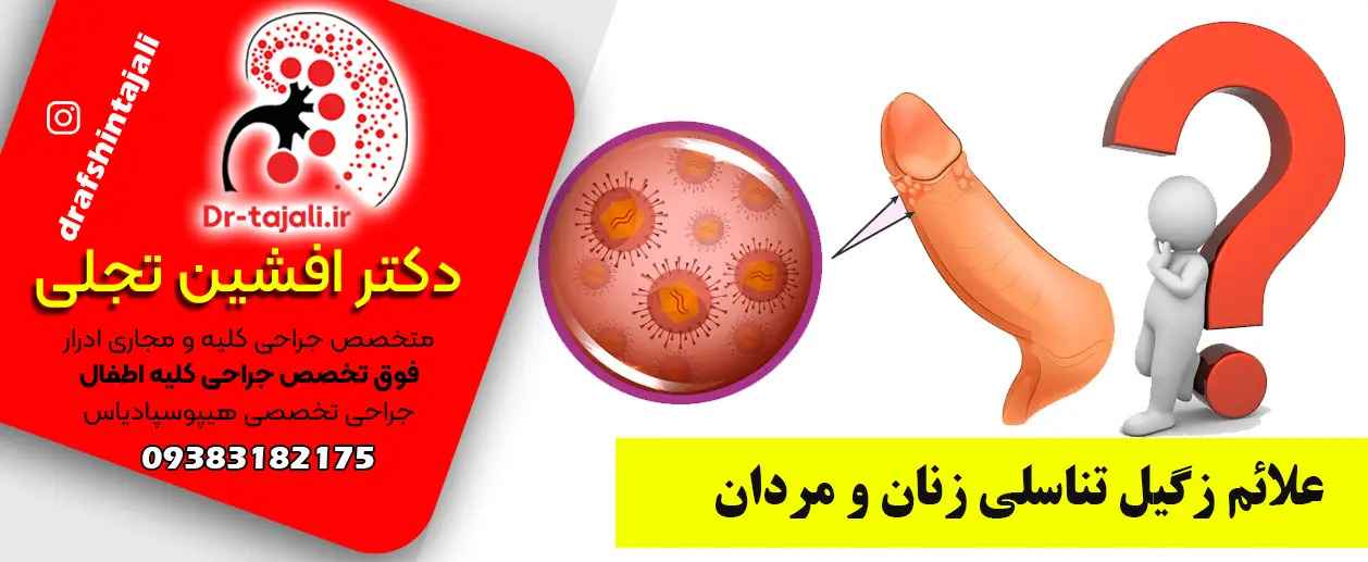 کلینیک فوق تخصصی دکتر افشین تجلی در اصفهان یکی از بهترین مراکز درمان زگیل تناسلی اصفهان برای زنان و مردان است.